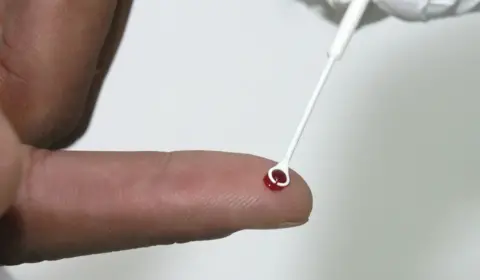 Saúde amplia vacina contra HPV para quem faz tratamento preventivo de HIV