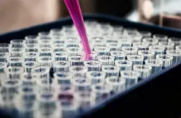 Exame de sangue detecta Alzheimer com mais precisão do que médicos, diz estudo