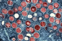 Mpox: conheça os sintomas e tire as principais dúvidas sobre a doença