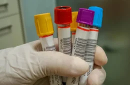 Rondônia intensifica ações de vigilância à febre do Oropouche