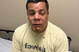 Candidato a vereador do PT é espancado no RJ e acusa Rodrigo Amorim pela agressão