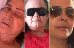 Chega a 10 o número de pessoas que perderam olho após mutirão no RN